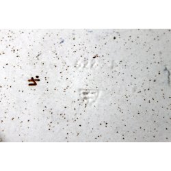 Michael Andersen fad